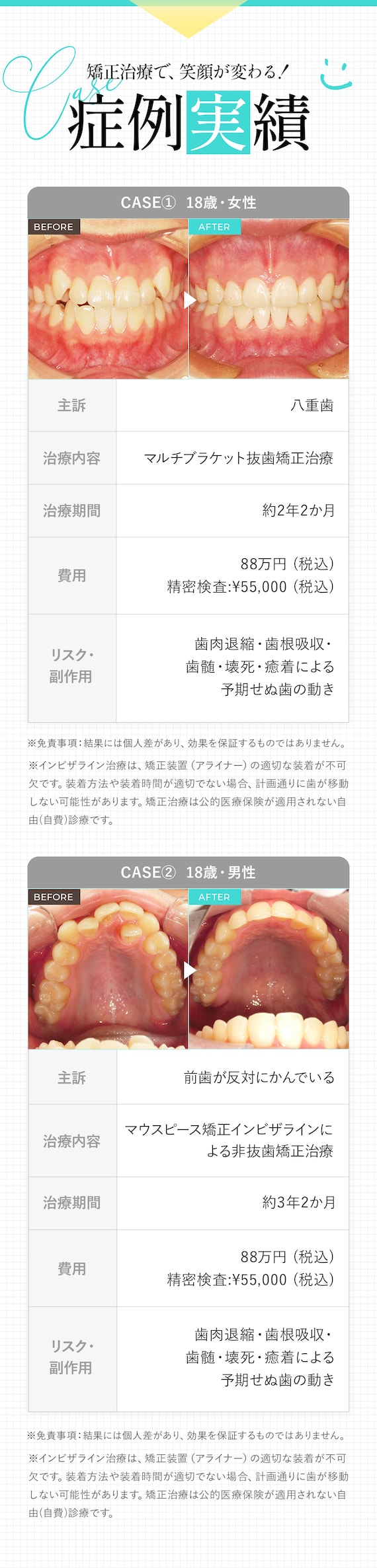 矯正治療で、笑顔が変わる!症例実績