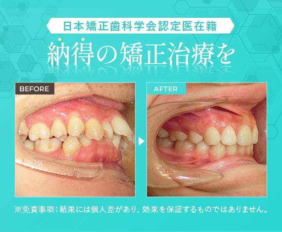 納得の矯正治療を