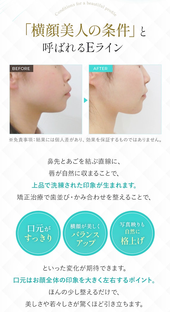 「横顔美人の条件」と呼ばれるEライン
